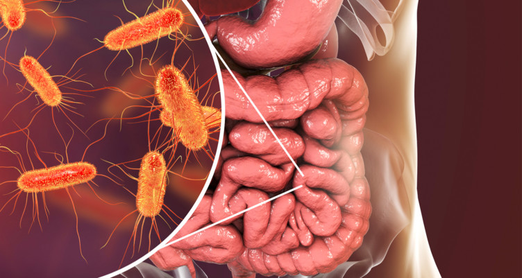 How to Own Your Gut Bacteria and Fix Leaky Gut Syndrome
