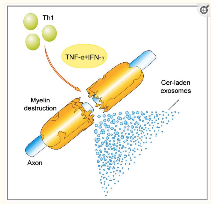 Decoding the Genetic Factors Behind Multiple Sclerosis