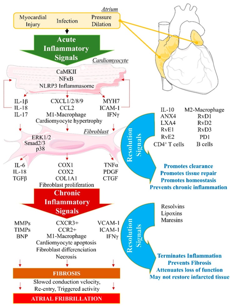 Atrial fibrillation: Intersection of genetic susceptibility with inflammation and remodeling